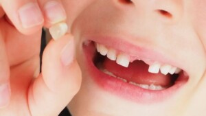 Saving your child’s baby teeth could SAVE their life: we’ll explain why