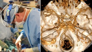 Neurosurgeon raise the alarm: never ignore these SYMPTOMS of a potential aneurysm