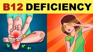 Vitamin B12 deficiency symptoms that are ignored by most people