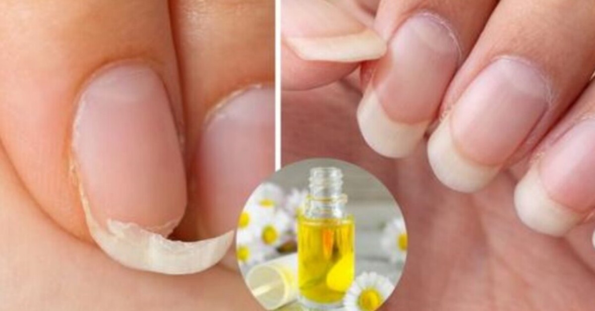 Natural elements that promote faster nail growth