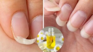 Natural elements that promote faster nail growth
