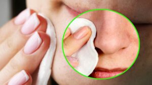 Have You Tried Them All? Now You Can Say Goodbye to Blackheads With These Natural Tricks