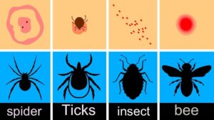 It’s Not Always About Mosquitoes, Like Figuring Out Which Bugs Bit You