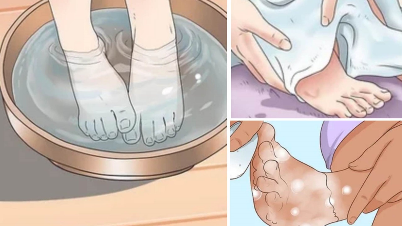 Get rid of calluses with these 10 natural solutions