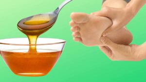 Soft and Smooth Feet? I’ll Tell You the Secret of the Honey Mask