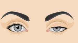 3 Tricks to Lift Sagging Eyelids