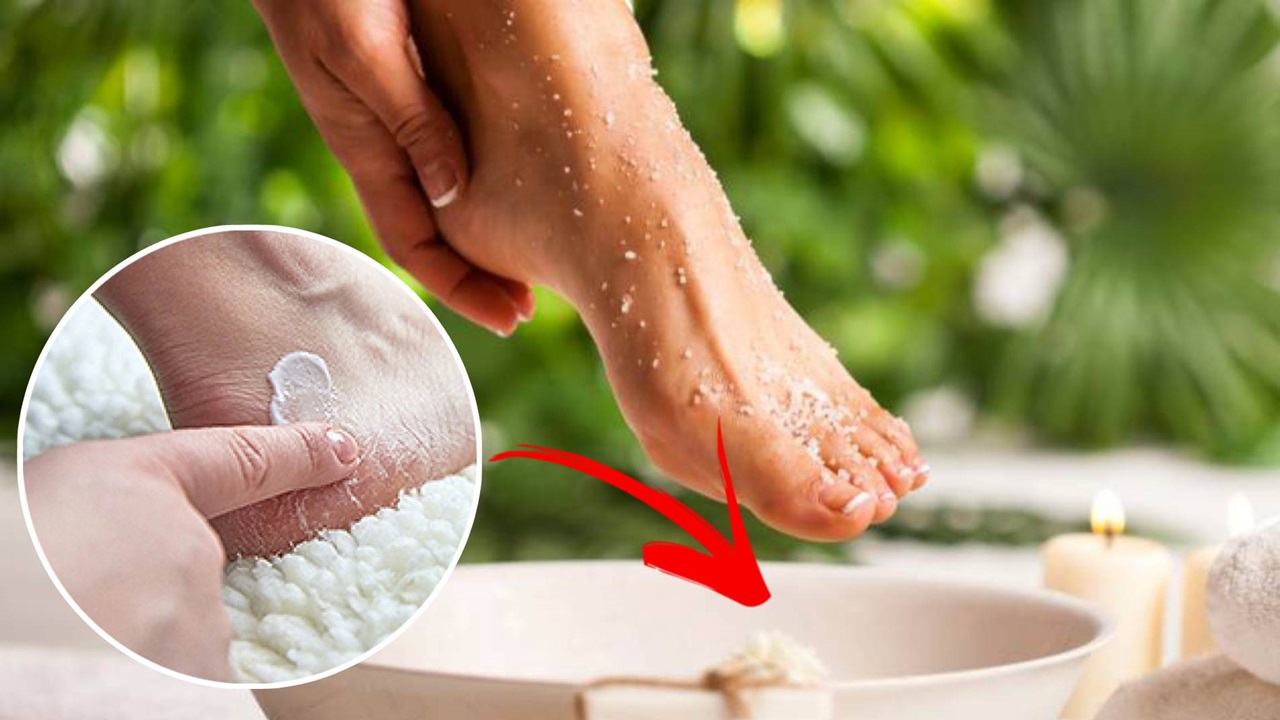 Scrub: a natural remedy for cracked heels