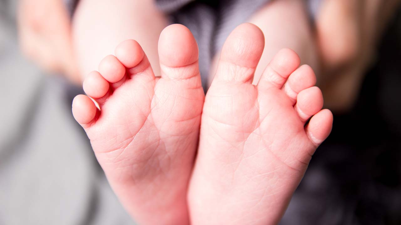 natural remedies to reduce calluses and corns on your feet