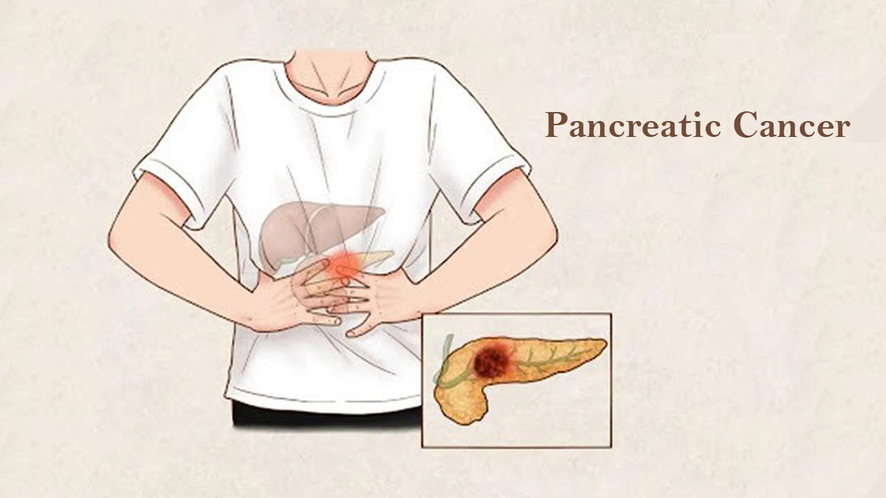 The typical warning signs of pancreatic cancer