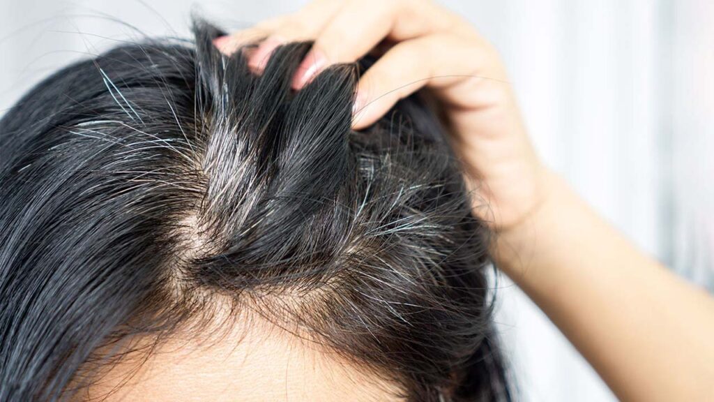Gray hair can be caused by a variety of reasons.